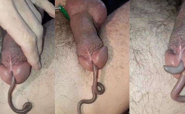 蚯蚓钻马眼恶趣味癖好