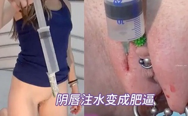 重口调教阴唇注水变成肥逼