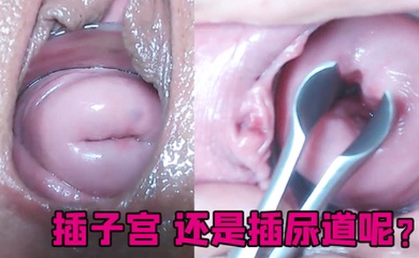 插子宫还是插尿道呢