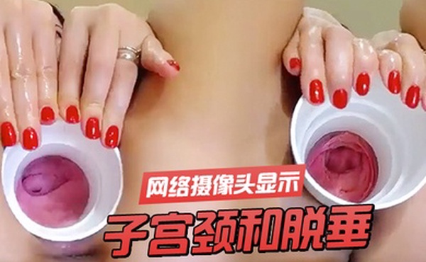 子宫颈和脱垂网络摄像头显示